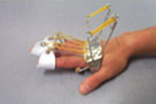 reverse knuckle bender splint 이미지