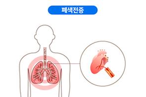 폐색전증